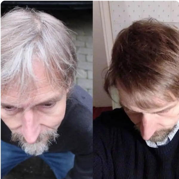 Before and After