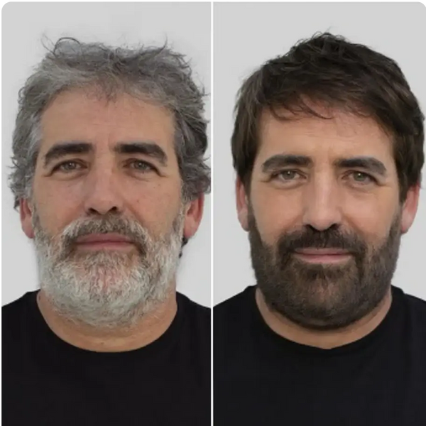Before and After