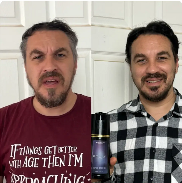 Before and After