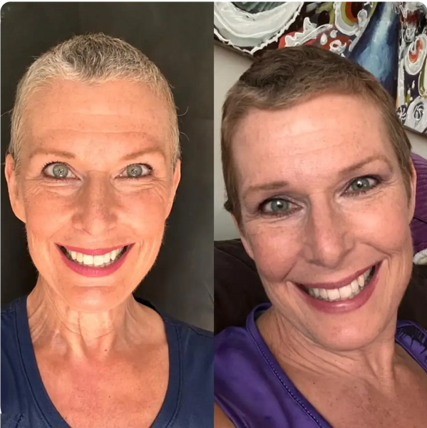 Before and After