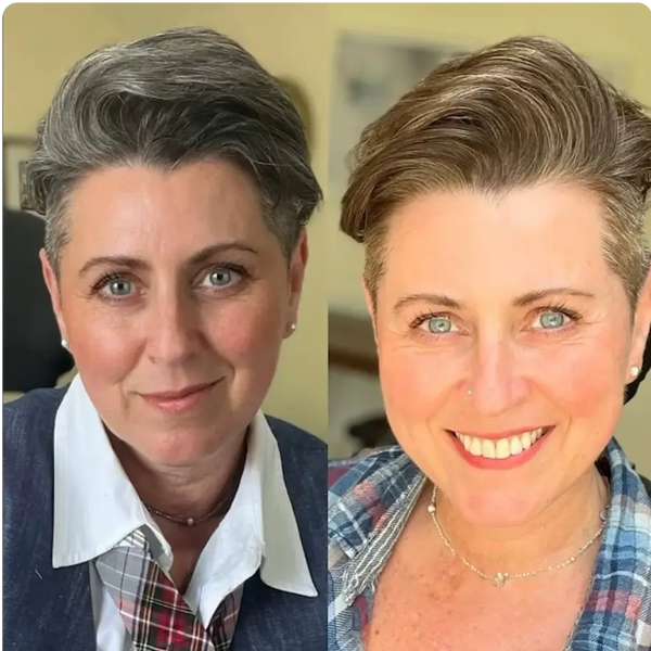 Before and After