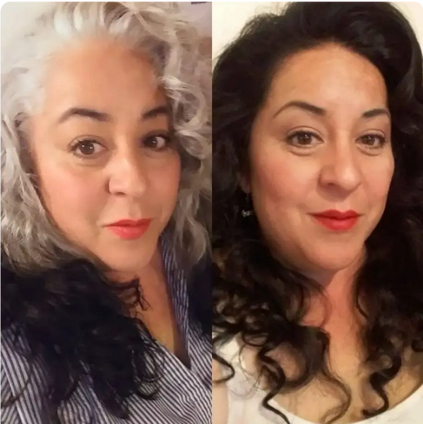 Before and After