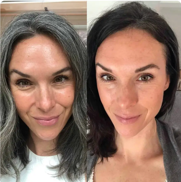 Before and After
